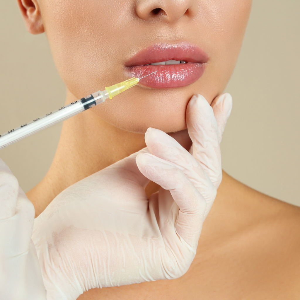 Contact us, a lady having botox and fillers around the lips and mouth area after contacting us at Battersea & Nine Elms Aesthetics Clinic, based inside Battersea Power Station – easily accessible from Nine Elms, Chelsea, Pimlico, Fulham, and Vauxhall.